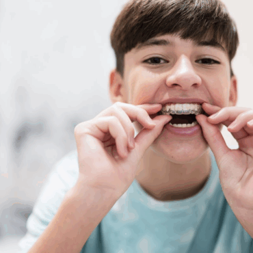 Invisalign voor kinderen