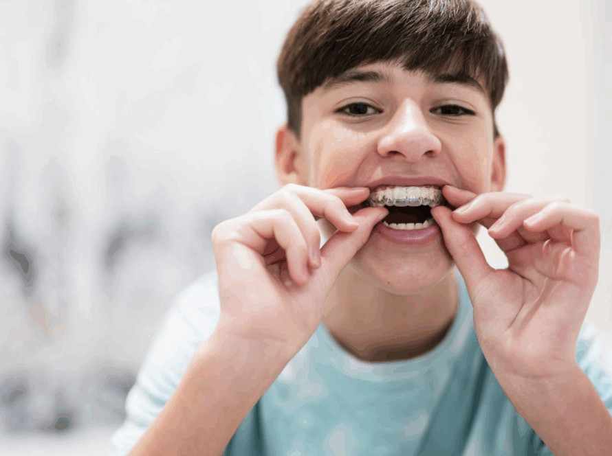 Invisalign voor kinderen