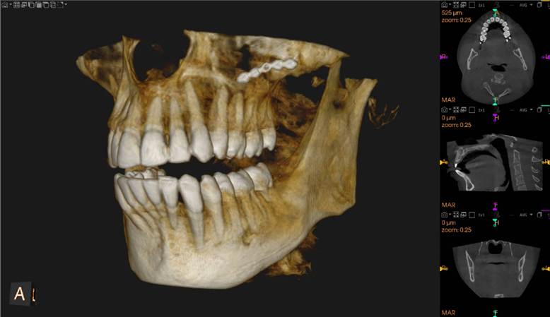 X-ray foto